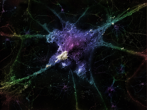 Neuron và bệnh Alzheimer 
