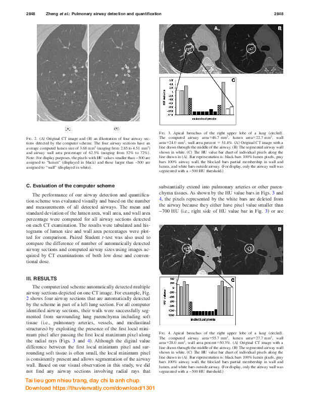 Automated detection and quantitative assessment of pulmonary airways depicted on CT images