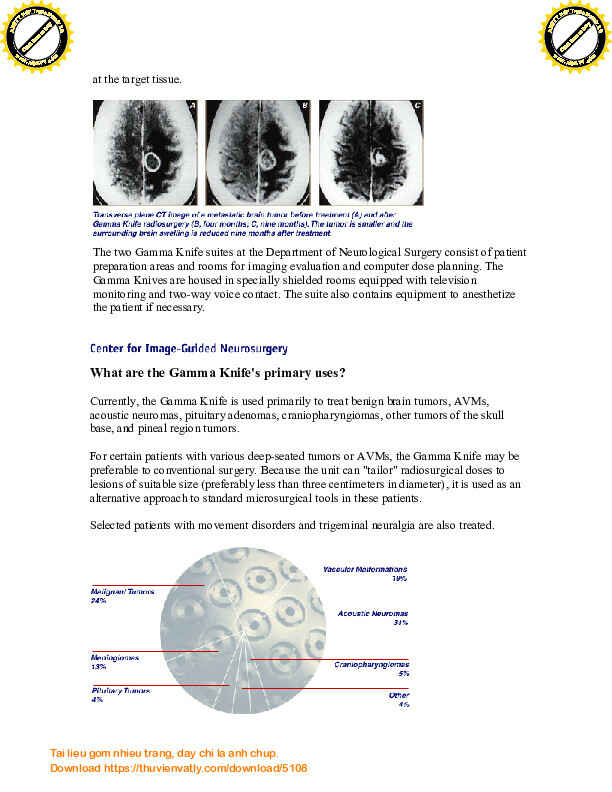 The Gamma Knife_A Technical Overview