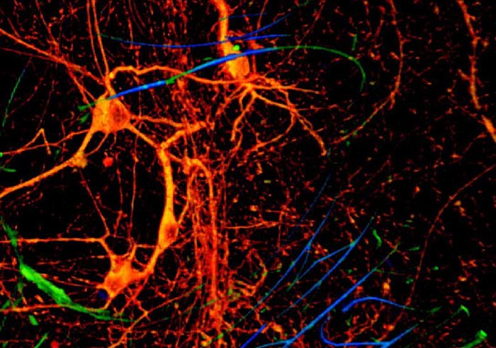 Ảnh 3D tái hiện lại cho thấy một mạng lưới gồm những bộ cảm biến nano (màu lam/lục) bên cạnh các neuron (màu đỏ) trong một mô cấy. 