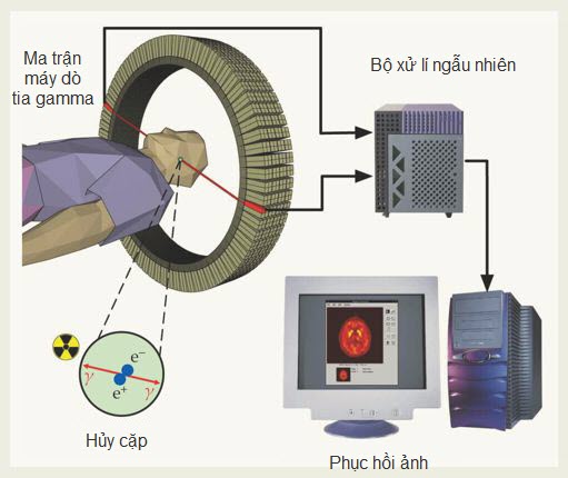 Kĩ thuật xạ positron vùng đầu của một bệnh nhân