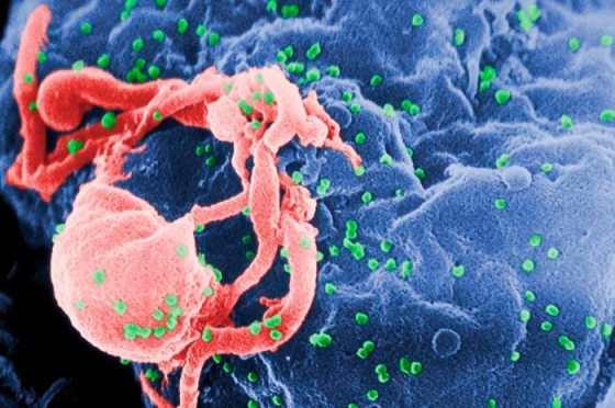 Mô hình mới cho văc-xin kháng HIV