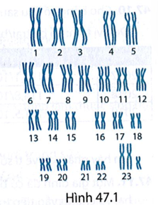 Bộ NST trong Hình 47.1 có thể là bộ NST của người mắc bệnh, tật di truyền nào?  A. Bệnh câm điếc bẩm sinh.

B. Hội chứng Klinefelter.

C. Tật hở khe môi,