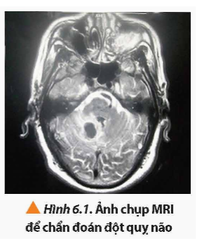 Để chẩn đoán những bất thường của não (Hình 6.1) và tuỷ sống; các bệnh liên quan đến tim mạch; bệnh liên quan đến các cơ quan nội tạng như gan, lá lách,