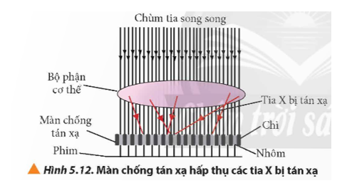 Quan sát Hình 5.12, giải thích vì sao màn chống tán xạ thường gồm những tấm chì được đặt xen kẽ với những tấm nhôm.