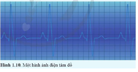 Tim co bóp theo nhịp do được điều khiển bằng một hệ thống các xung điện dẫn truyền (ảnh 1)