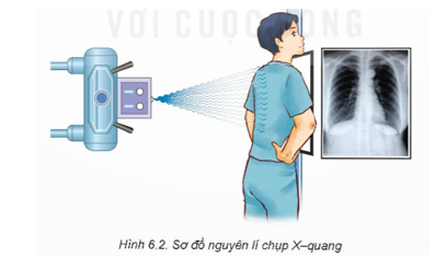 1. Máy chụp cảnh X - quang được đặt sao cho bộ phận phát tia X nằm phía trên vùng cơ thể cần chụp. Khi vận hành, chùm tia X có cùng cường độ từ bộ phận phát tia X xuyên qua vùng cần chụp. Các cơ quan khác nhau của cơ thể có khả năng hấp thụ tia X khác nhau, cường độ của chùm tia X sau khi đi qua các cơ quan này cũng sẽ suy giảm khác nhau. Từ đó, ảnh chụp X - quang được thể hiện trên phim hoặc được tái tạo trên máy tính. Càng có nhiều tia X chiếu được đến phim thì hình ảnh thu được càng tối. Do đó, những bộ phận cơ thể rỗng hoặc đầy khí thì sẽ cho màu đen; chất béo và cơ bắp cho hình ảnh màu xám, các mô đặc như xương sẽ cản trở nhiều tia X và cho ra hình ảnh trắng trên phim.

2. Các cơ quan khác nhau của cơ thể có khả năng hấp thụ tia X khác nhau, cường độ của chùm tia X sau khi đi qua các cơ quan này cũng sẽ suy giảm khác nhau. Càng có nhiều tia X chiếu được đến phim thì hình ảnh thu được càng tối. Do đó, những bộ phận cơ thể rỗng hoặc đầy khí thì sẽ cho màu đen; chất béo và cơ bắp cho hình ảnh màu xám, các mô đặc như xương sẽ cản trở nhiều tia X và cho ra hình ảnh trắng trên phim.

3.  Ưu điểm của chụp X - quang:

- Không xâm lấn, không đau.

- Kỹ thuật đơn giản, dễ sử dụng.

- Sử dụng liều bức xạ thấp hơn chụp cắt lớp vi tính (CT Scan).

- Quá trình chụp nhanh chóng. Các kỹ thuật X - quang vi tính hóa đã giúp xử lý và cho ra kết quả nhanh chóng, lưu trữ dễ dàng.

- Chi phí thấp hơn so với các phương pháp khác như CT hay MRI.

b. Hạn chế của chụp X - quang:

- Hình ảnh X - quang không chi tiết, rõ nét bằng CT và MRI.

- Không cung cấp hình ảnh 3D.

- Chụp X - quang thông thường không hiển thị tốt hình ảnh các mô và cơ quan, cần sử dụng chất cản quang khi muốn chụp các vùng như đường tiêu hóa, buồng tử cung – vòi trứng… 