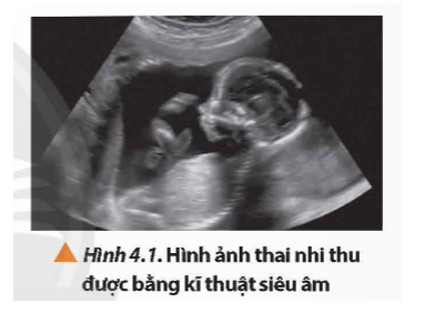 Trong y học, kĩ thuật chẩn đoán bằng sóng siêu âm (thường được gọi là kĩ thuật siêu âm hay siêu âm) được sử dụng phổ biến để thu được hình ảnh của một bộ phận cần được quan sát trong cơ thể như siêu âm bụng, siêu âm thai nhi (Hình 4.1), ... Nhờ đó, các bác sĩ có thể quan sát và chẩn đoán tình trạng sức khoẻ của bệnh nhân hoặc theo dõi sức khoẻ của thai nhi trong thai kì. Vậy kĩ thuật siêu âm dựa trên những tính chất nào của sóng?   (ảnh 1)